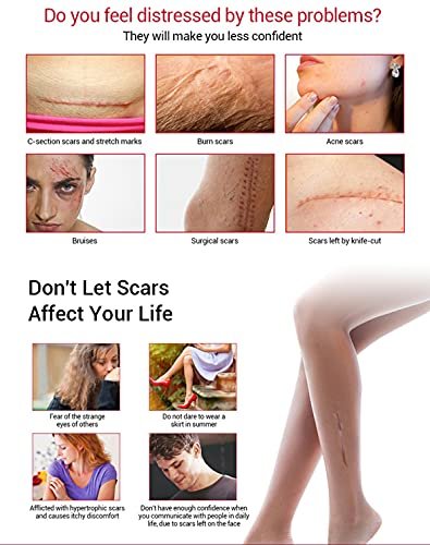 AICHUN BEAUTY Scar Removal Facial Serum Pimples Stretch Marks Face Moisturizing Body Remove Scars Kojic Acid Vitamin E - Image 3