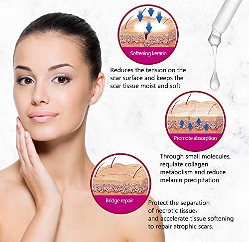 AICHUN BEAUTY Scar Removal Facial Serum Pimples Stretch Marks Face Moisturizing Body Remove Scars Kojic Acid Vitamin E - Image 5